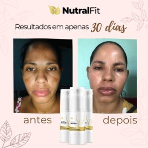 Antes e Depois Nutralfit